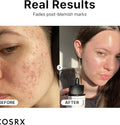 COSRX Niacinamide 15 Serum