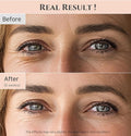 Beauty of Joseon Revive Eye Serum