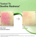 ANUA Azelaic Acid 10 Hyaluron Redness Soothing Serum