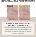 Skin1004 Centella Light Cleansing Oil