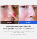 MEDICUBE Zero Pore Pad 2.0
