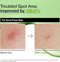 ANUA Azelaic Acid 10 Hyaluron Redness Soothing Serum