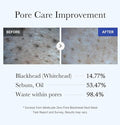 Medicube Zero Pore Blackhead Mud Mask