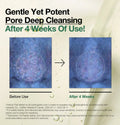 ANUA Double Cleansing Duo Set Of 2